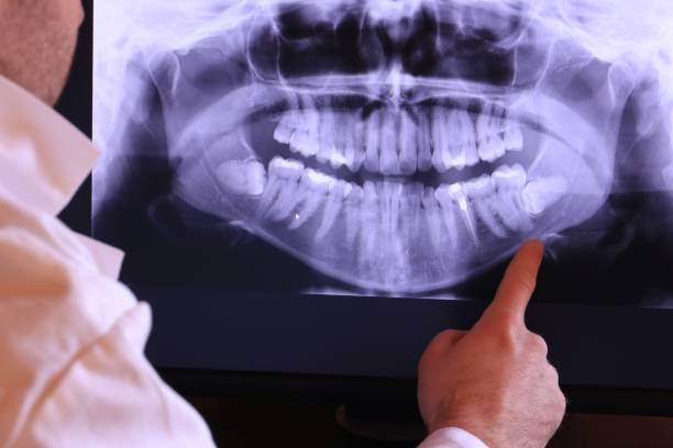 Best Weekend Emergency Dental Services in Gleed, WA